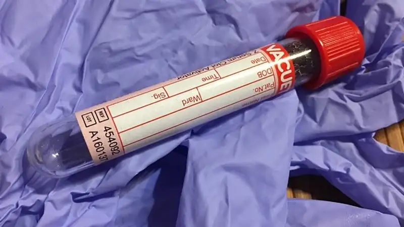 Сотни использованных пробирок нашли на обочине жители Алматинской области