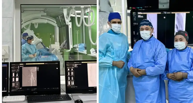 Эндоваскулярная хирургия: новые возможности в реканализации диализных фистул в Алматы