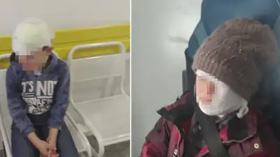 Двух детей госпитализировали после нападения собаки в ВКО 