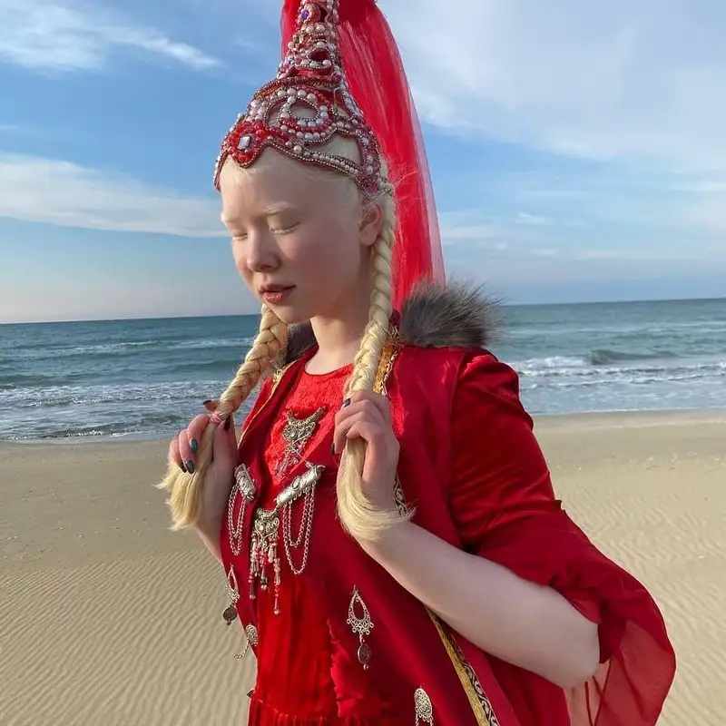 Ангелы во плоти: как живут единственные сестры-альбиносы в Казахстане, фото - Новости Zakon.kz от 13.12.2023 12:18
