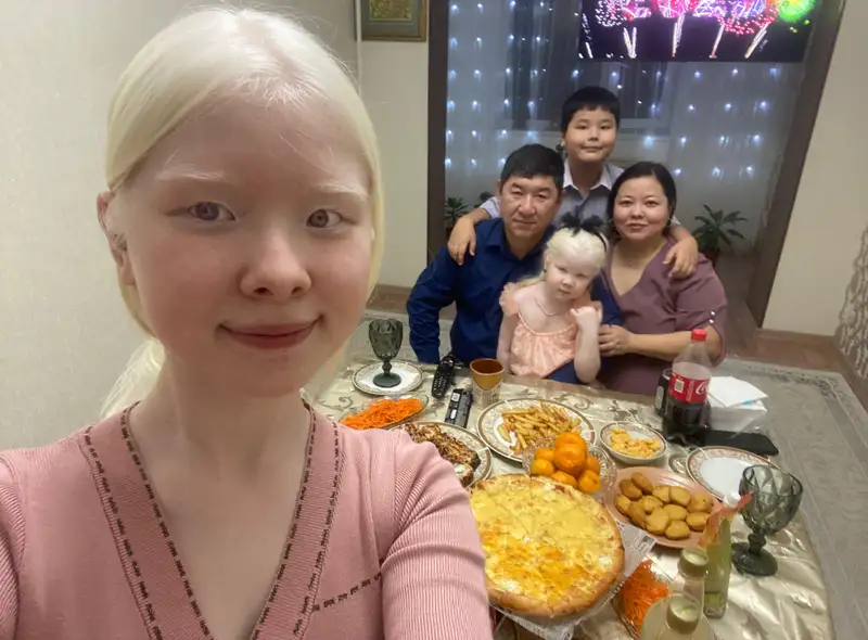 Ангелы во плоти: как живут единственные сестры-альбиносы в Казахстане, фото - Новости Zakon.kz от 13.12.2023 12:18