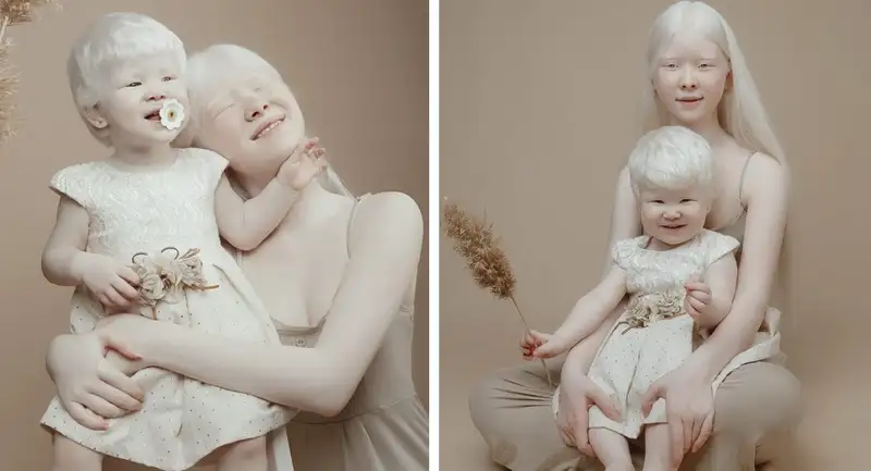 Ангелы во плоти: как живут единственные сестры-альбиносы в Казахстане