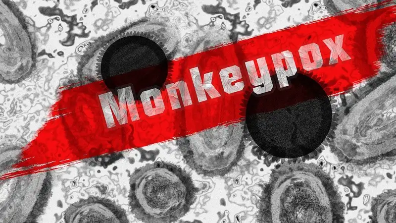 В Японии скончался первый пациент, зараженный оспой обезьян