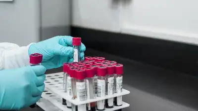 риск вспышки холеры в мире, фото - Новости Zakon.kz от 23.03.2023 10:59