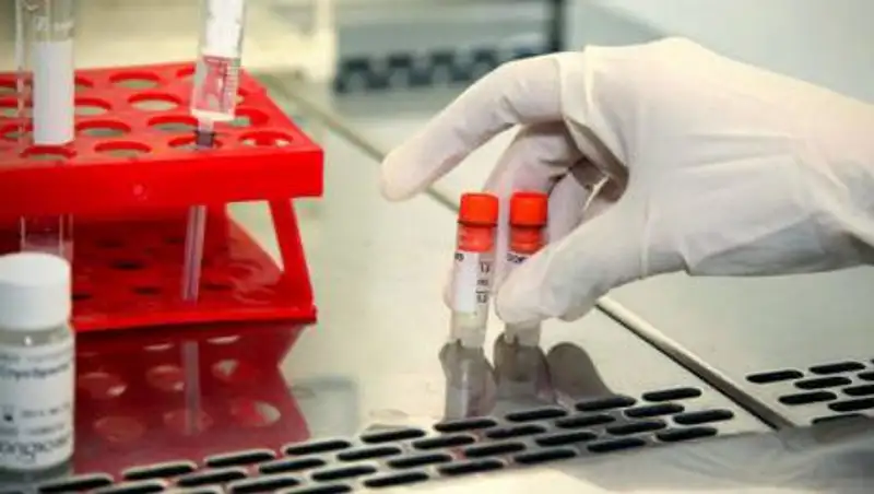 Стали известны условия проведения донорства половых клеток в Казахстане