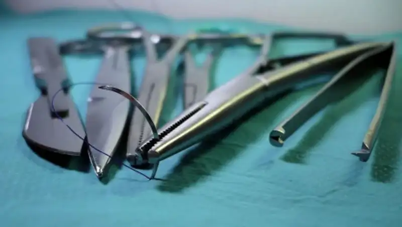 "Глаза вылезали из орбит". Удаление аппендицита сделало мальчика инвалидом