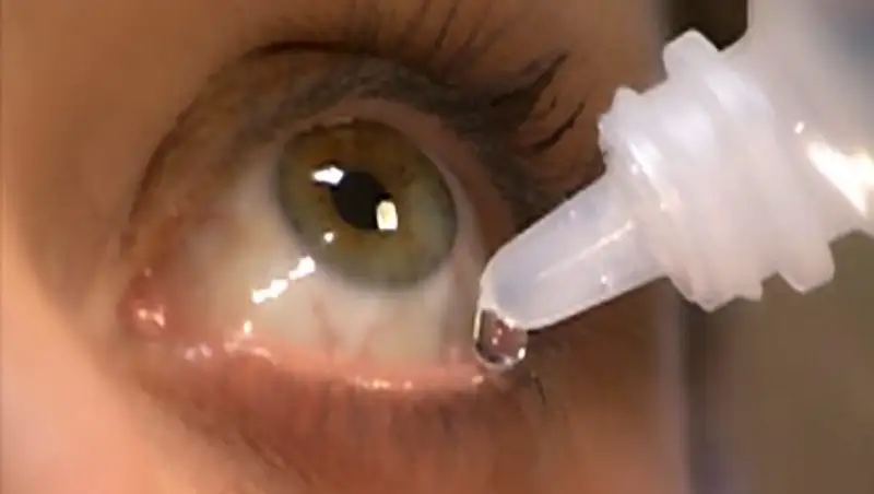 Что делать при воспалении век