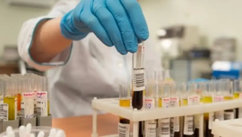 Еще четыре казахстанских спортсмена дисквалифицированы за допинг