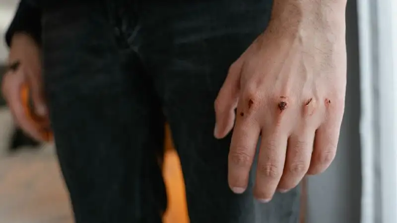 Драка закончилась поножовщиной в Усть-Каменогорске