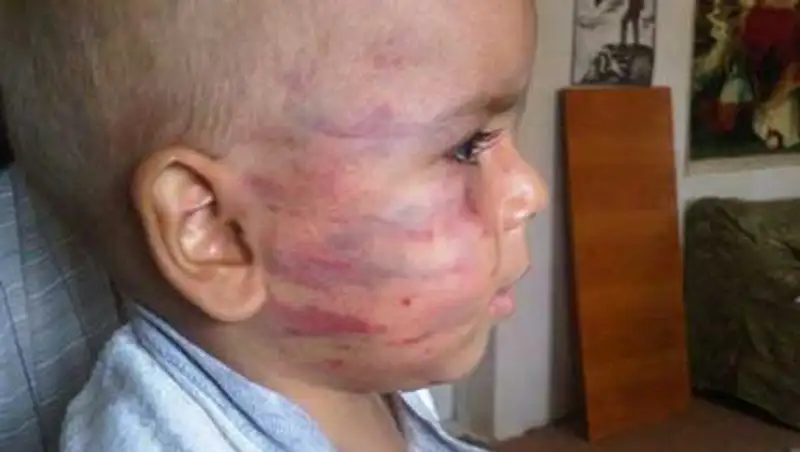 3-летний мальчик был жестоко избит 27-летним мужчиной в Алматинской области