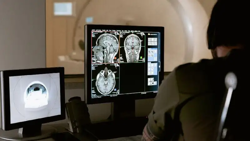 Врач назвала ранние признаки рассеянного склероза