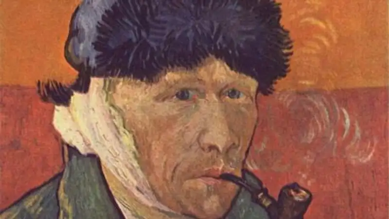 В Германии выставлено ухо ван Гога, выращенное из клеток праправнука его брата