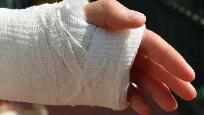 В Уральске на детской площадке ребенку отрезало фаланги двух пальцев, фото - Новости Zakon.kz от 01.08.2022 14:53