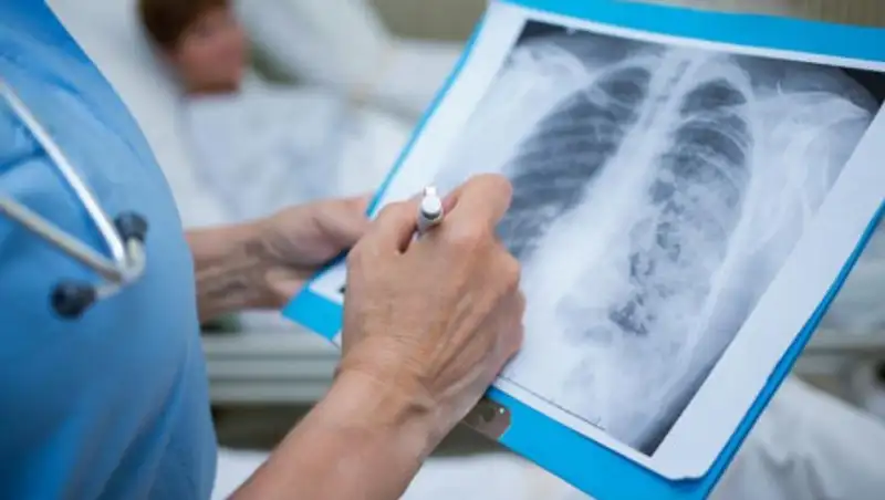 18 случаев коронавирусной пневмонии зарегистрировано за сутки в Казахстане