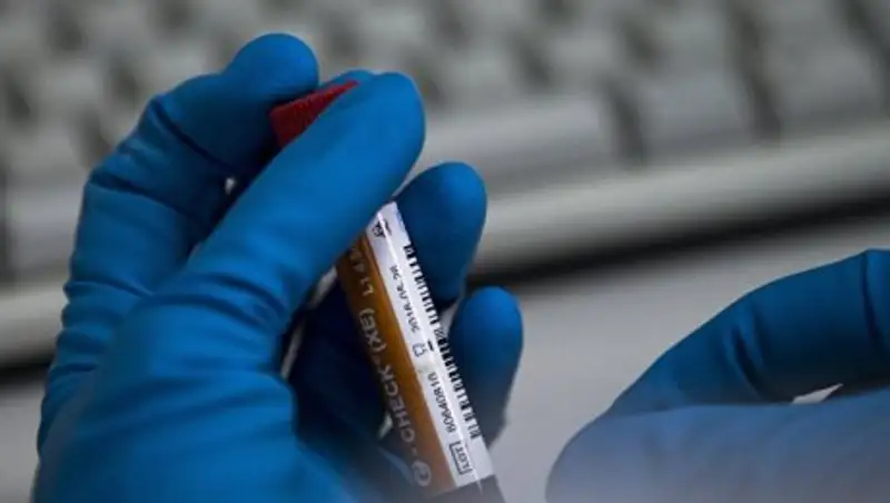 Главы антидопинговых агентств 17 стран призвали реформировать WADA