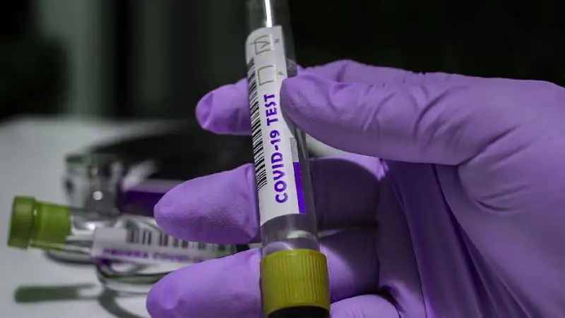 94 случая коронавируса выявили за сутки в Казахстане