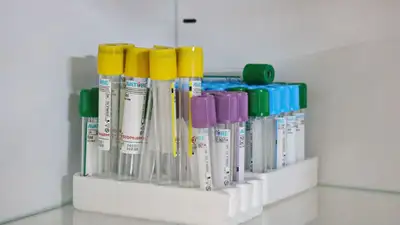 Вдвое выросла суточная заболеваемость COVID-19 в Казахстане, фото - Новости Zakon.kz от 31.01.2023 09:20