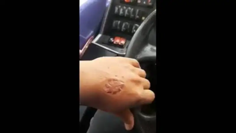 В Алматы пассажирка укусила водителя за просьбу надеть маску