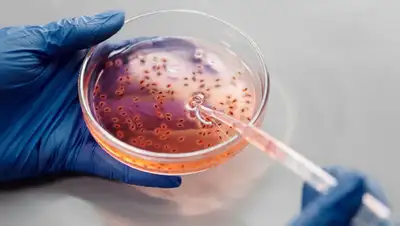 выявлены заболевшие вирусом оспы обезьян , фото - Новости Zakon.kz от 02.06.2022 19:19