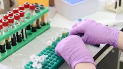 pixabay, фото - Новости Zakon.kz от 01.09.2021 08:00