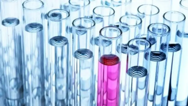 Семь карантинных пунктов будут предотвращать ввоз лихорадки Эбола в Мангистау