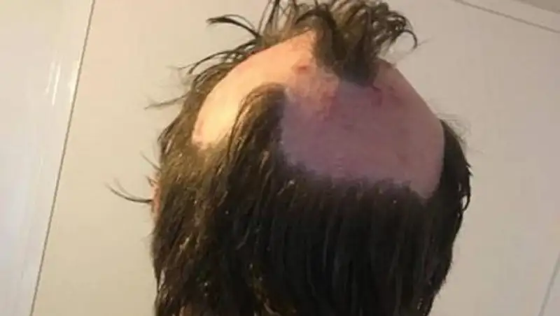 Мать пошла на поводу у моды, покрасив волосы дома, и осталась без скальпа