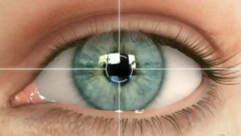 Признаки астигматизма. Как не прозевать проблему