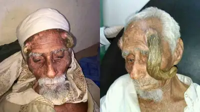 рог на голове, фото - Новости Zakon.kz от 17.03.2023 16:02