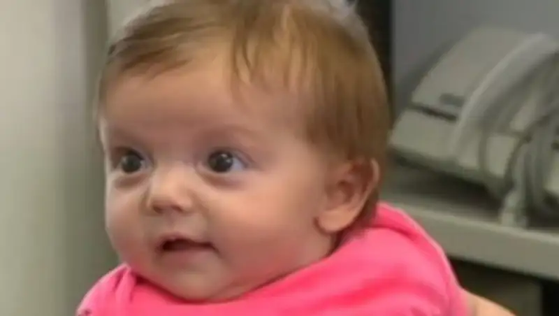 Напечатанный на 3D-принтере череп спас новорождённую девочку