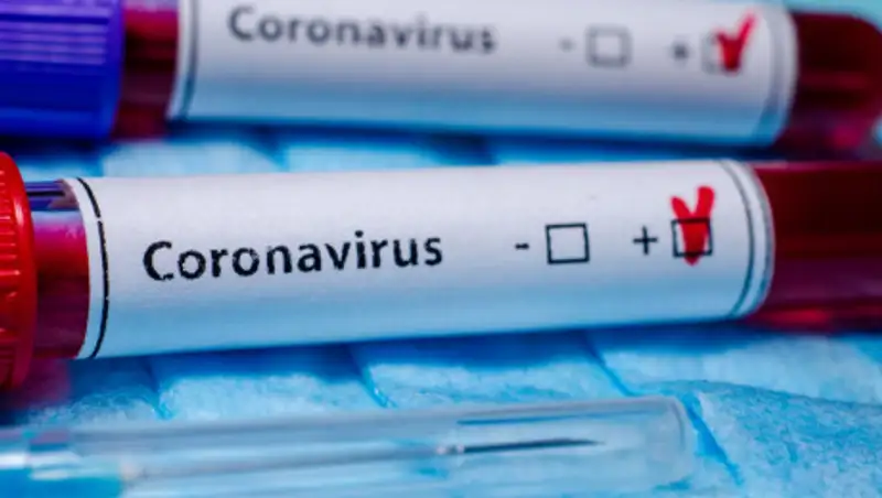 Число заразившихся коронавирусом в мире превысило 13 миллионов человек