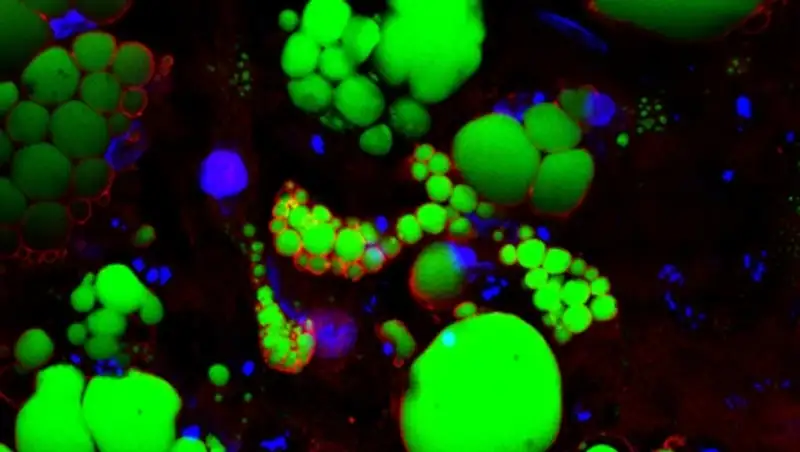 Ученые тестируют сверхэффективное лекарство от ожирения