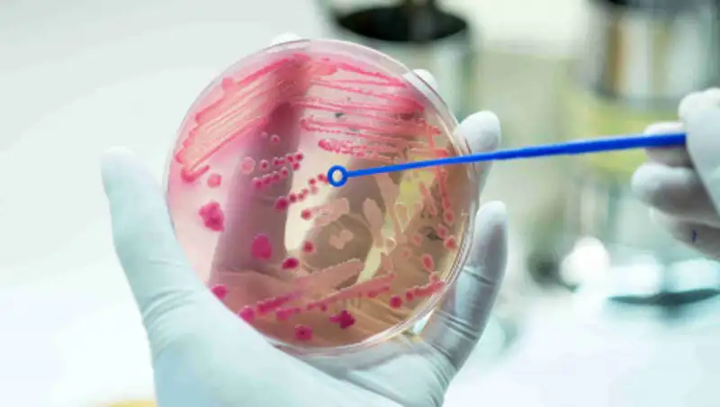 Советы медиков, как избежать заболевания менингококковой инфекцией