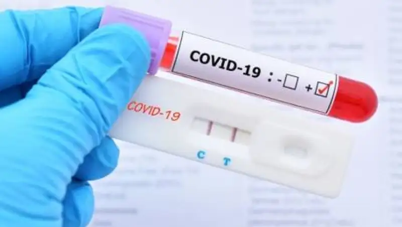 Опубликованы данные по смертности от коронавируса в Казахстане