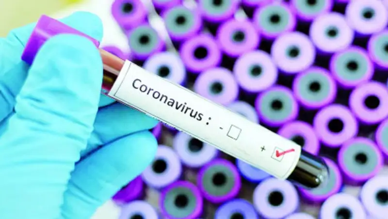 В России скончался первый больной коронавирусом