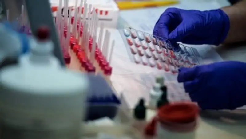 Казахстанцы неохотно становятся донорами спермы – эксперт