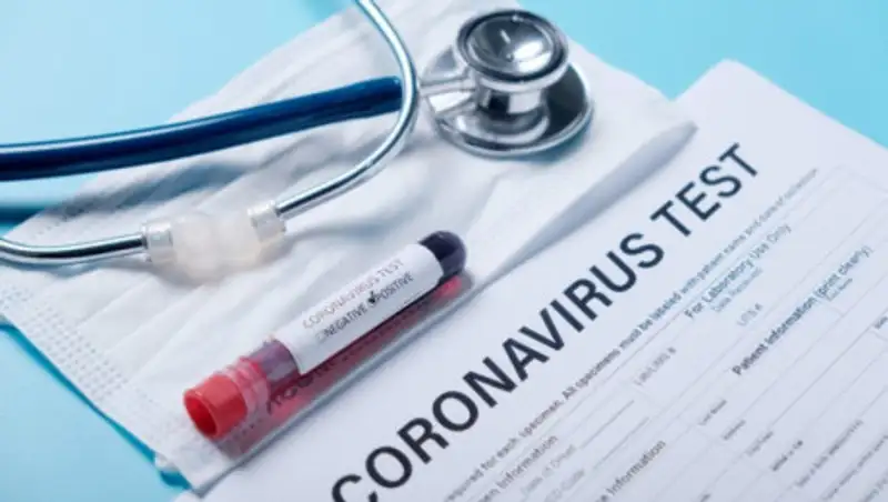 Ветеринарные службы подключат к ПЦР-тестированию в Казахстане