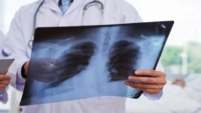 159 случаев и 12 смертей - о коронавирусной пневмонии за сутки