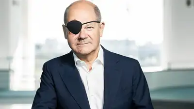 Олаф Шольц опубликовал фото с "пиратской" повязкой на глазу
