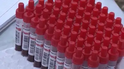 Карантин ввели в селе Акмолинской области из-за бруцеллеза , фото - Новости Zakon.kz от 15.07.2023 05:59