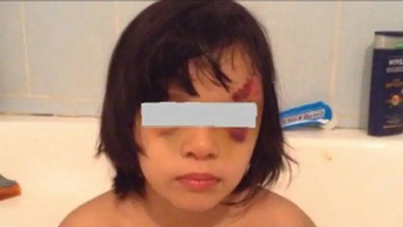 В Шымкенте в очередной раз мать жестоко избила ребенка