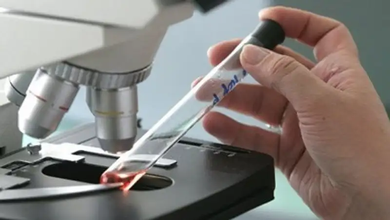 В Караганде возбуждено уголовное дело по факту массового заболевания гепатитом А