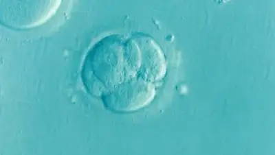 pixabay, фото - Новости Zakon.kz от 18.03.2021 07:24