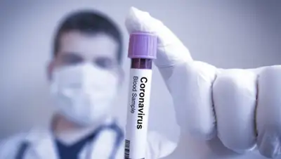 gdb.rferl.org, фото - Новости Zakon.kz от 06.08.2020 12:47