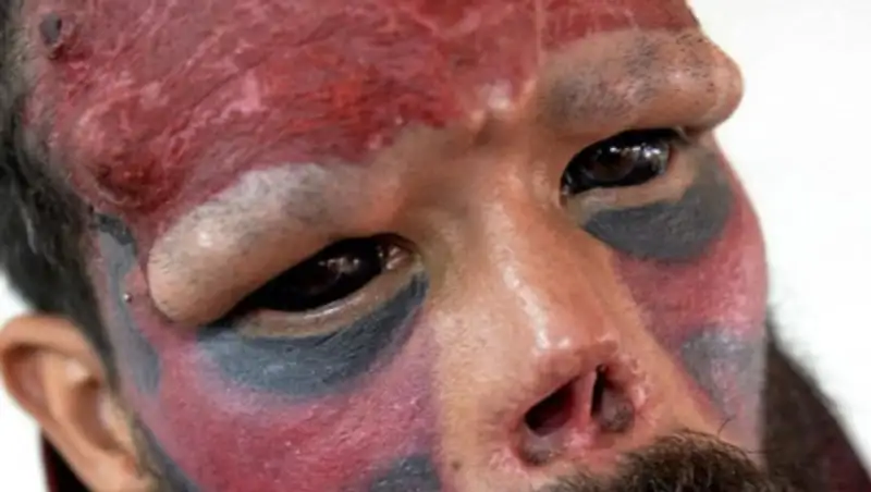 Фанат комиксов отрезал себе нос, чтобы быть похожим на любимого героя