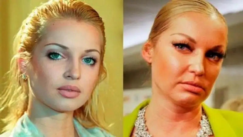 Из прекрасного лебедя в гадкого утенка: знаменитости, потерявшие свою красоту