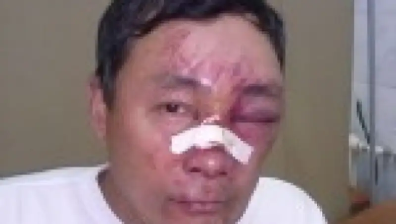 В Темиртау избили пенсионера МВД