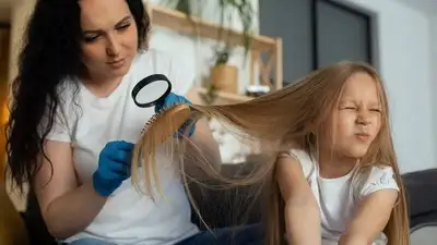 Медики рассказали, как не подцепить вшей в школе и в детском саду, фото - Новости Zakon.kz от 06.09.2023 06:24