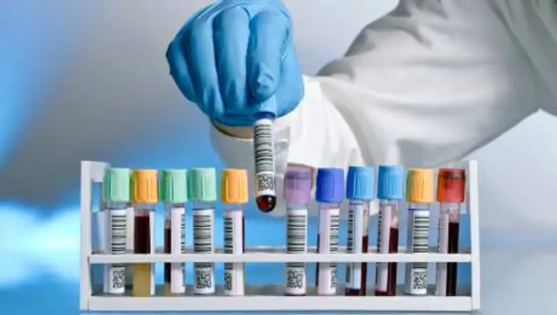 За сутки 60 человек заразились коронавирусом в Казахстане