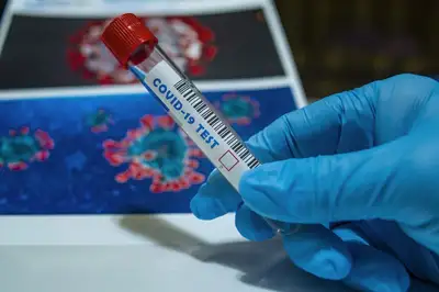 частные лаборатории могут диагностировать коронавирус без получения разрешения, фото - Новости Zakon.kz от 21.12.2022 12:23