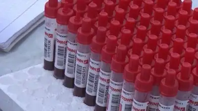 21 человек заразился бруцеллезом в ЗКО , фото - Новости Zakon.kz от 31.07.2023 04:56